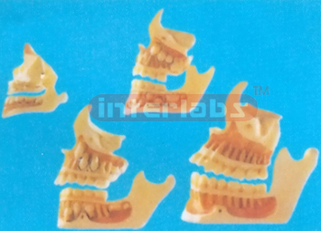 DEVELOPMENT OF A SET OF TEETH